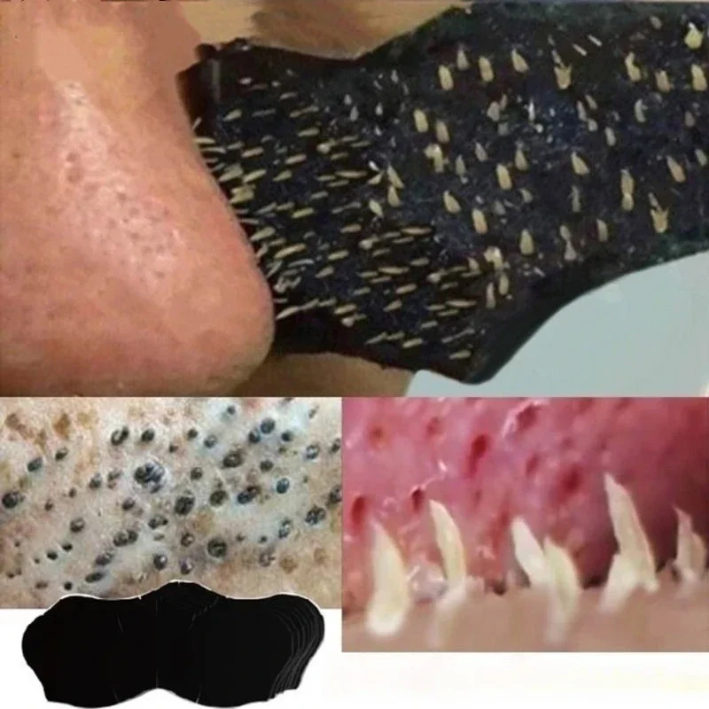 Unisex Blackhead Remove Mask N - Charcoal Pore Strip recensie en prijs