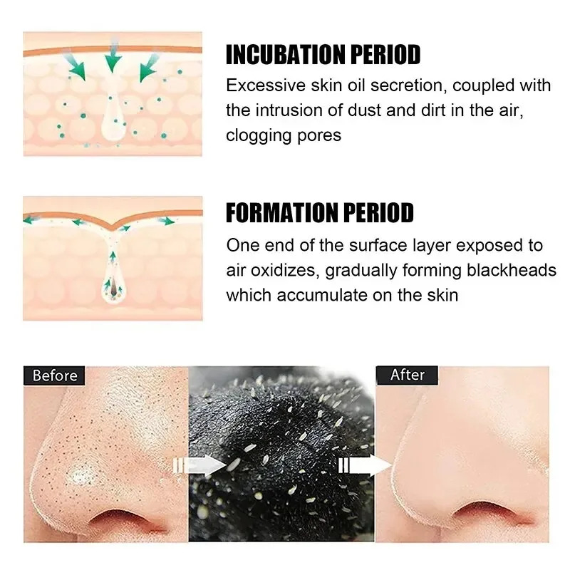 10/150PCS Mee-eter Verwijderen - Charcoal Pore Strip recensie en prijs